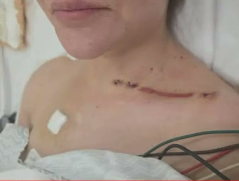 Ex pareja de Cerimedo revela impactantes fotos de sus heridas tras ataque