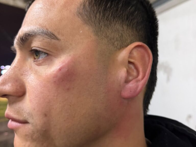 Violencia en el fútbol: Jugadores de Patronato agredidos por sus propios hinchas tras derrota